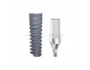 Implants - ICB006